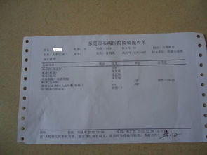 白帶常規(guī)檢查結果怎么看